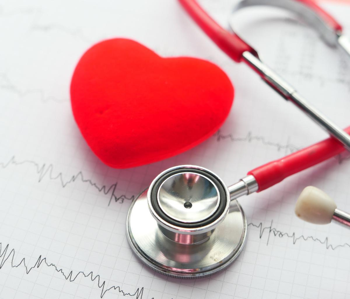 Elettrocardiogramma (ECG)