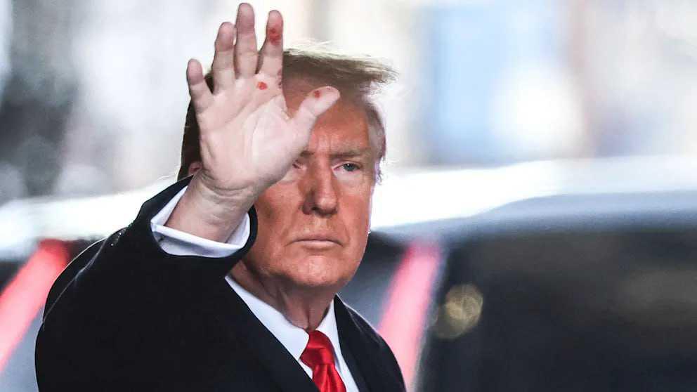 Des photos de Donald Trump suscitent des rumeurs sur sa santé Des photos de Donald Trump suscitent des rumeurs sur sa santé