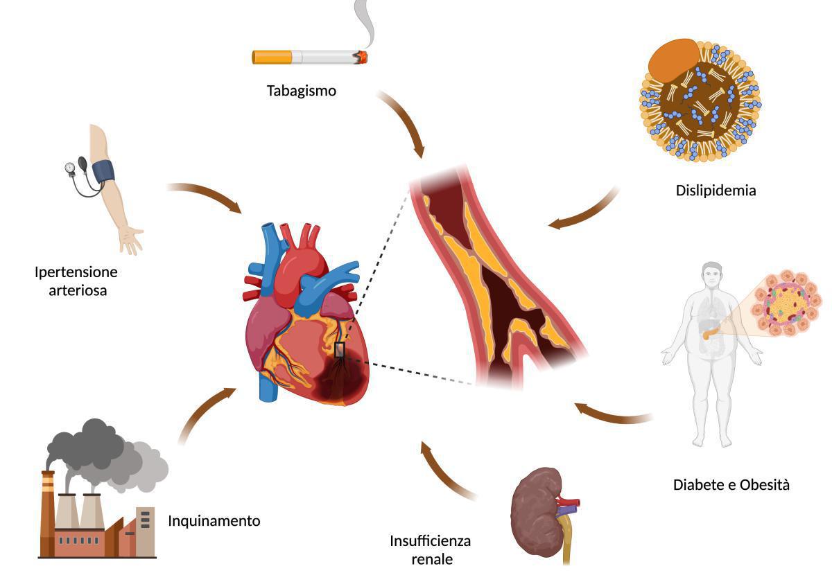 Cardiopatia ischemica acuta e prevenzione cardiovascolare