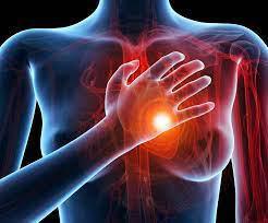 Cardiopatia Ischemica Cronica e Prevenzione Cardiovascolare Cardiopatia Ischemica Cronica e Prevenzione Cardiovascolare