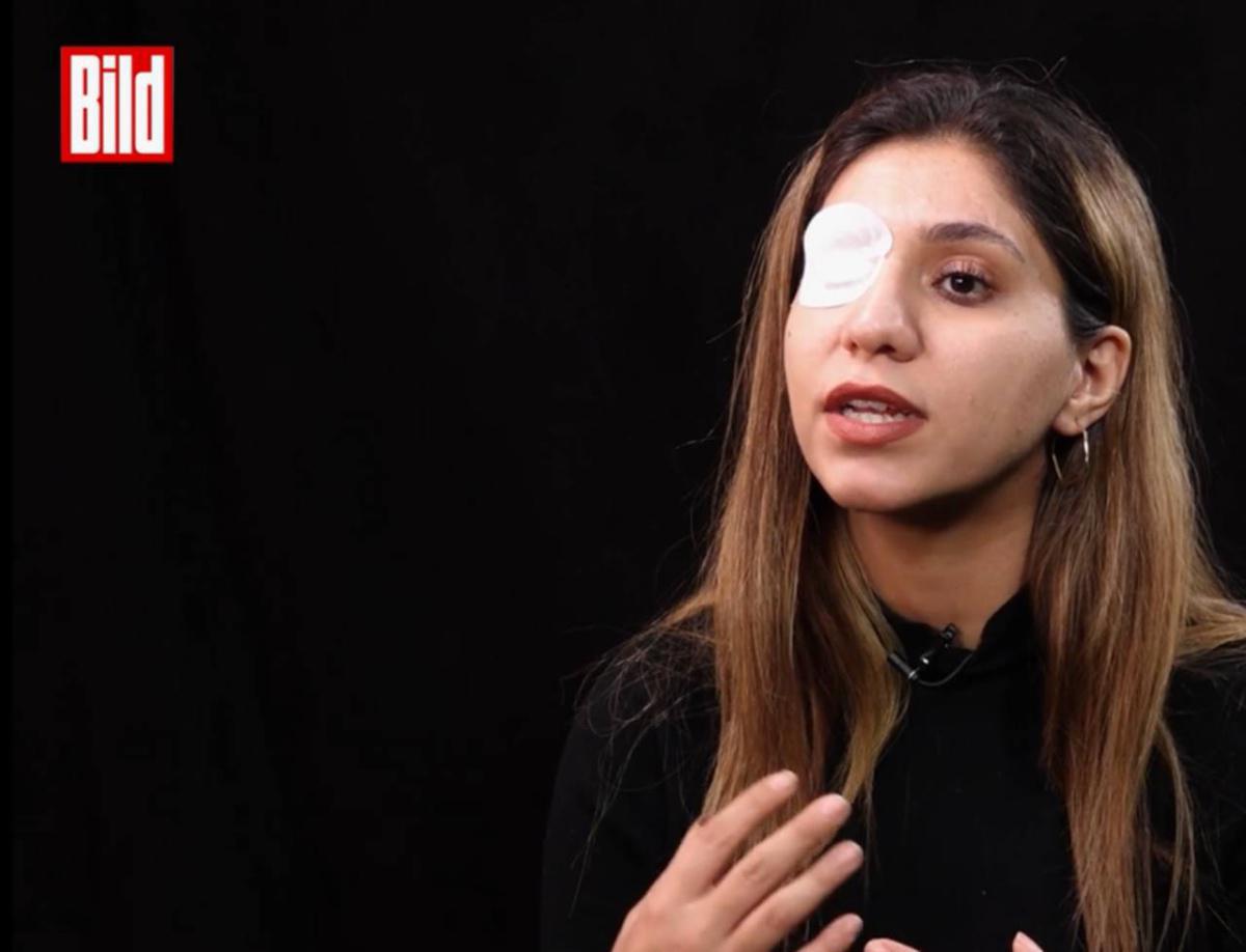 5000 جريح في العيون: الإستراتيجية القاسية لقوات الأمن الإيرانية لإخماد الاحتجاجات 5000 جريح في العيون: الإستراتيجية القاسية لقوات الأمن الإيرانية لإخماد الاحتجاجات