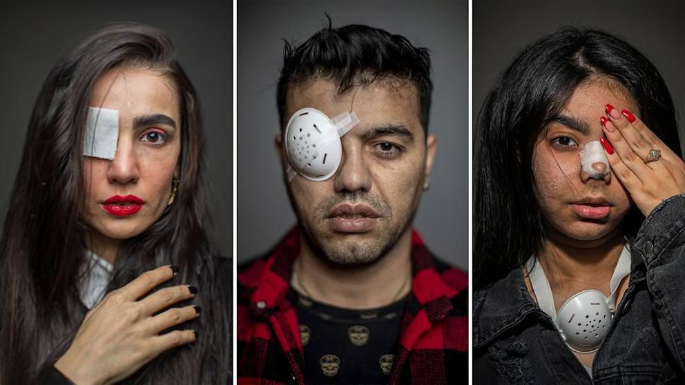 5000 جريح في العيون: الإستراتيجية القاسية لقوات الأمن الإيرانية لإخماد الاحتجاجات 5000 جريح في العيون: الإستراتيجية القاسية لقوات الأمن الإيرانية لإخماد الاحتجاجات