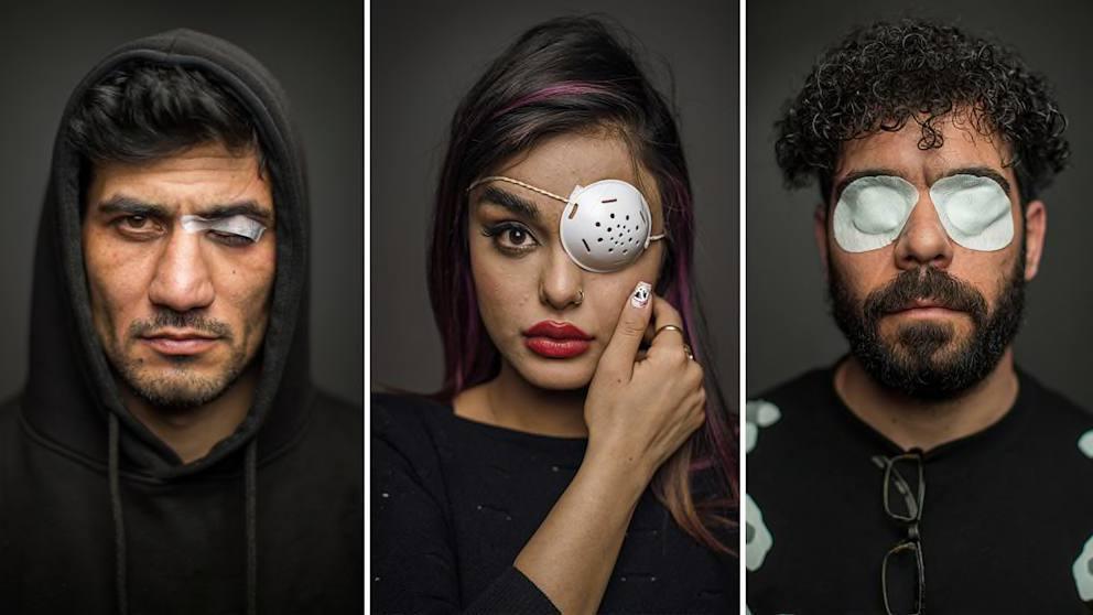 5000 جريح في العيون: الإستراتيجية القاسية لقوات الأمن الإيرانية لإخماد الاحتجاجات 5000 جريح في العيون: الإستراتيجية القاسية لقوات الأمن الإيرانية لإخماد الاحتجاجات