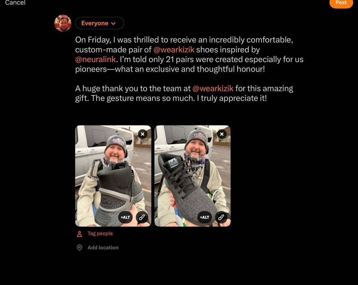 رائد تجربة «نيورالينك» يكشف مئة يوم مع الشريحة الدماغية رائد تجربة «نيورالينك» يكشف مئة يوم مع الشريحة الدماغية