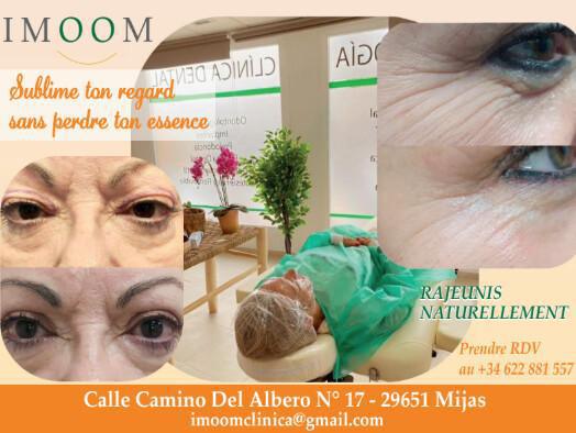 Clínica IMOOM | Mijas Costa