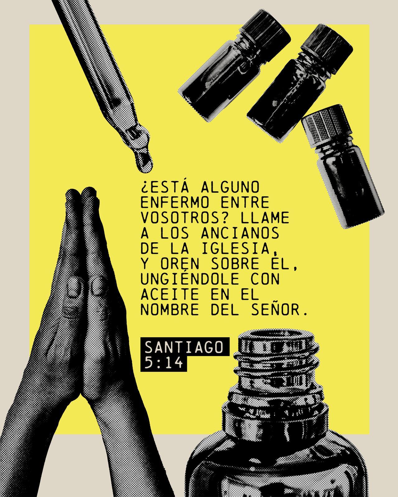 Santiago 5: 14