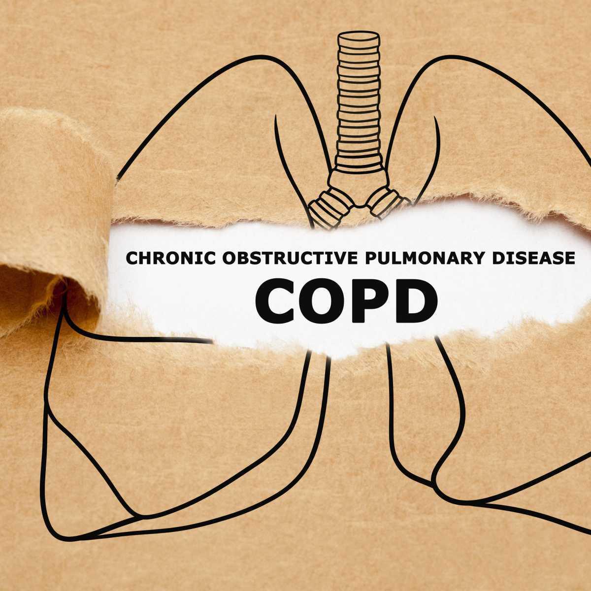 Doença pulmonar obstrutiva crônica