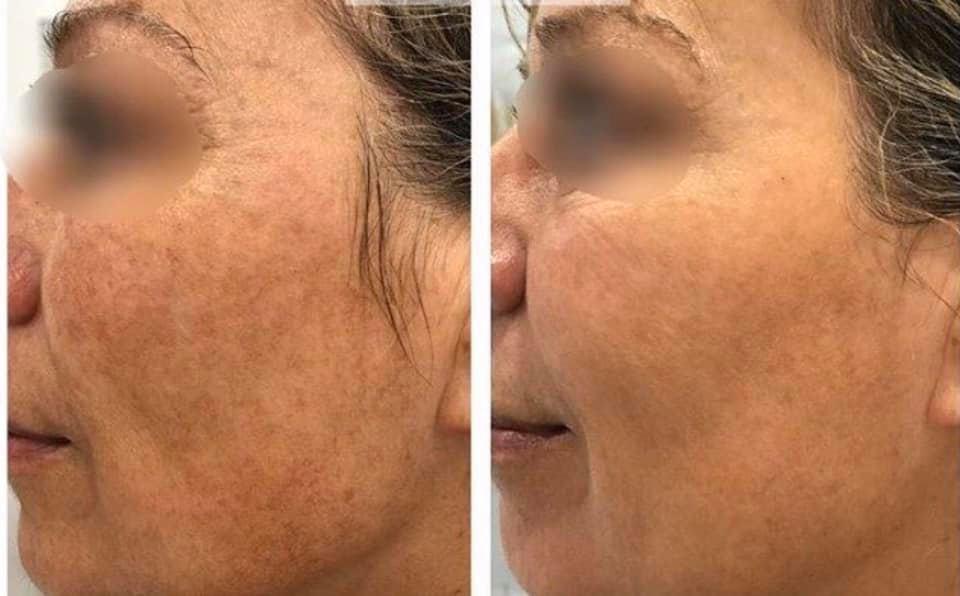 Clínica de Medicina Estética DAT