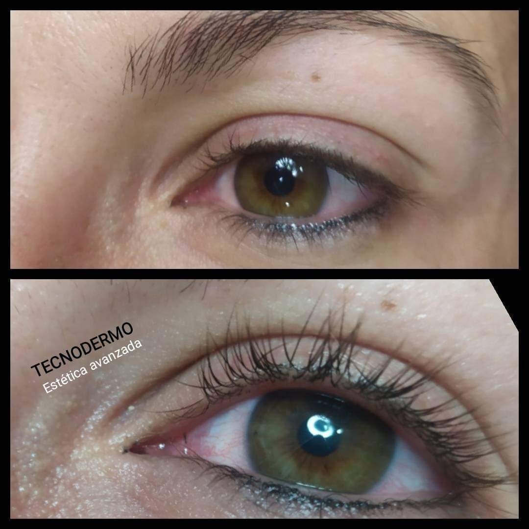 Tecnodermo Tecnodermo