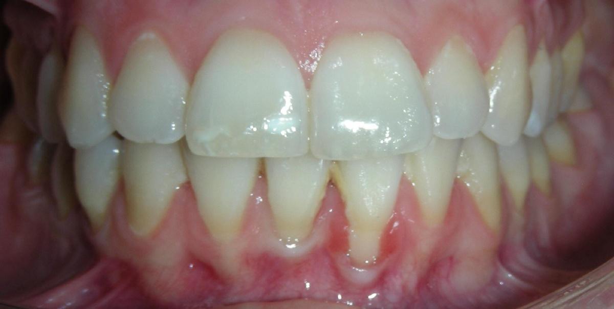 CLINICA DENTAL FERNANDO ROMÁN CLINICA DENTAL FERNANDO ROMÁN