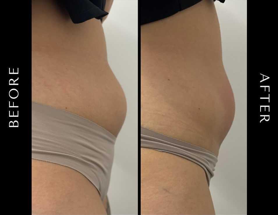 FISIOTERAPIA ESTETICA