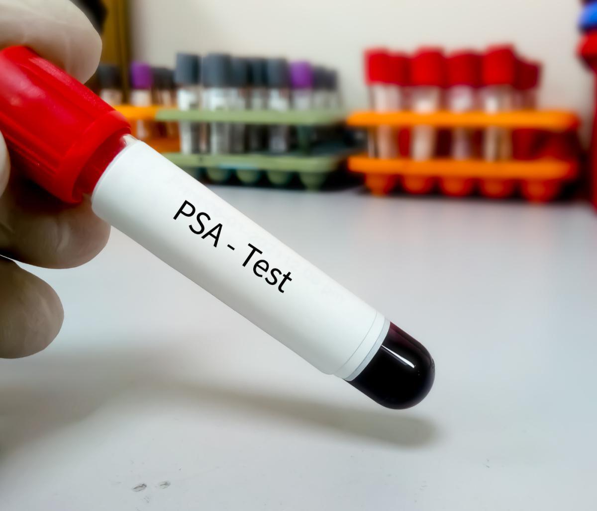 Test PSA