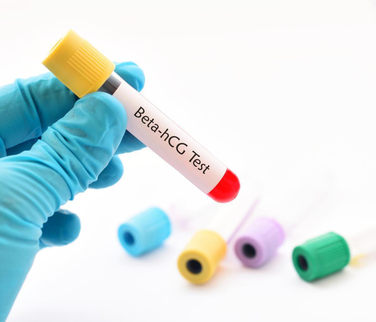 Test Beta-hCG Test Beta-hCG