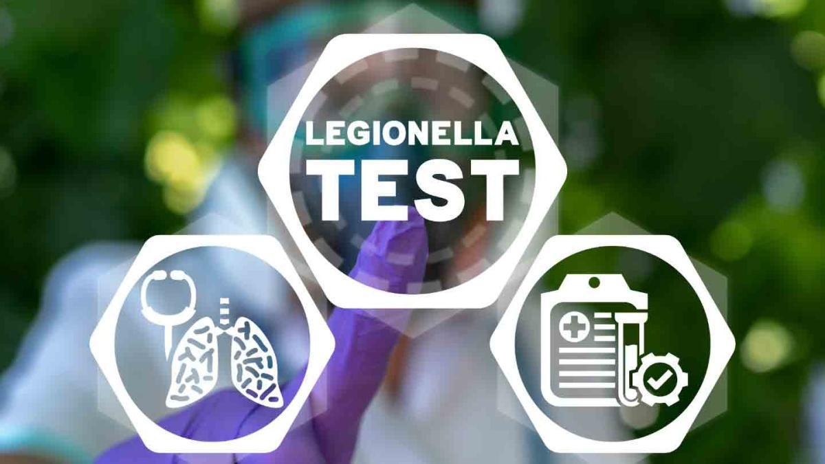 Cómo prevenir la legionelosis en tu rutina. Recuerda: Agua estancada, riesgo invisible.