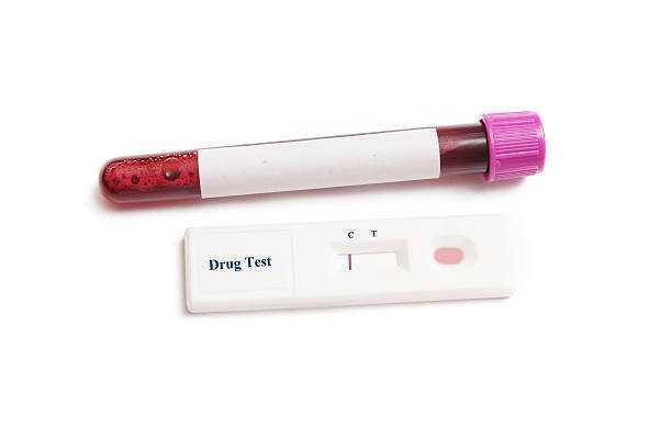 Votre employeur peut-il vous obliger à faire un test antidrogue ?