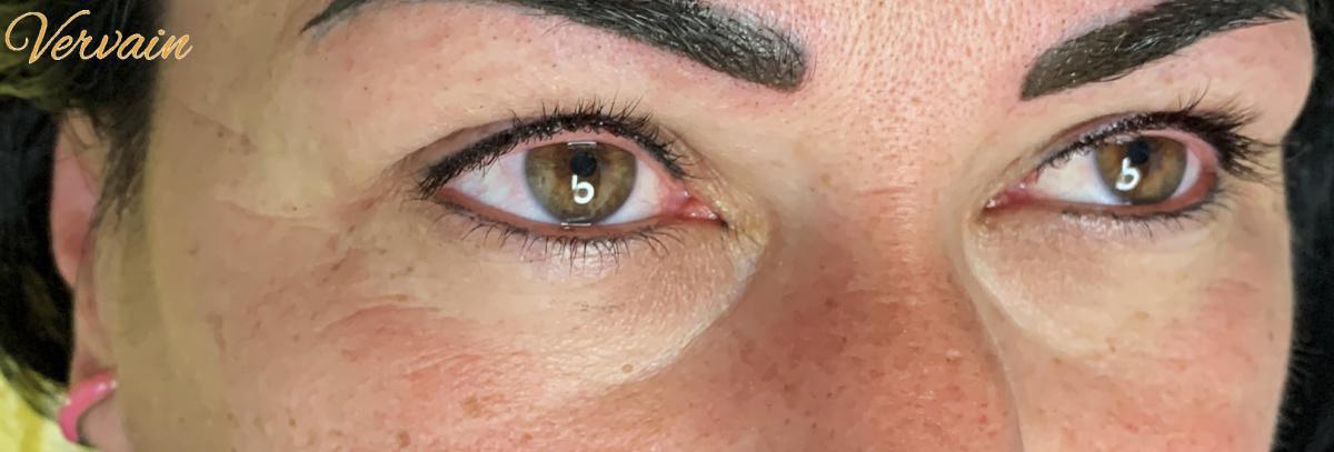 Dermopigmentazione Dermopigmentazione