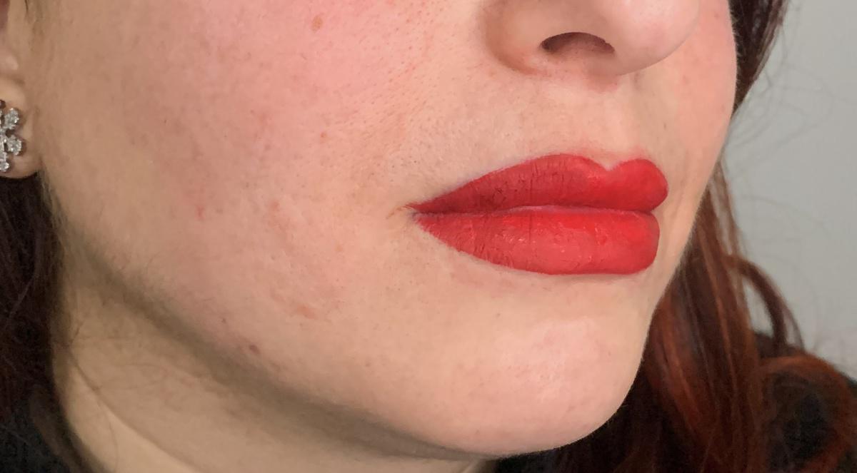 Dermopigmentazione Dermopigmentazione