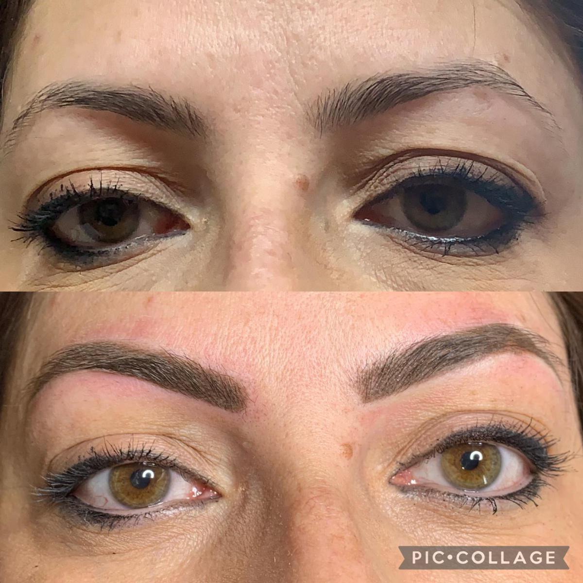 Dermopigmentazione Dermopigmentazione