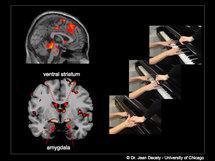 Activación neuronal ante imágenes de daño intencionado. Fuente: Universidad de Chicago.