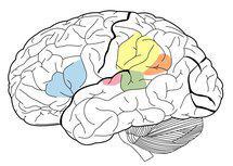 Algunas de las áreas cerebrales asociadas con el lenguaje: Área de Broca (Azul), Área de Wernicke (Verde), Supramarginal gyrus (Amarillo), Angular gyrus (Naranjado) ,Primary Auditory Cortex (Rosado). James.mcd.nz. Wikipedia.