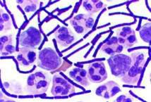 Bacillus anthracis. Fuente: Wikimedia Commons.