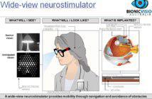 Fuente: Bionic Vision Australia.