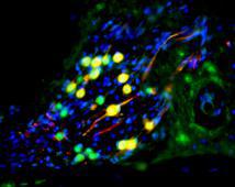 Una neurona auditiva derivada de células madre repuebla la cóclea de un jerbo sordo. Las células humanas son las coloreadas en verde. El color rojo es un marcador de diferenciación neuronal. Imagen: Marcelo Rivolta, Universidad of Sheffield. Fuente: SINC.