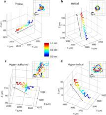 Los gametos masculinos se mueven de cuatro maneras, principalmente. Fuente: Grupo de Investigación Ozcan, de UCLA.