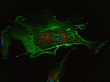 Célula observada con un microscopio de fluorescencia. Imagen: IP69.226.103.13. Fuente: Wikimedia Commons.