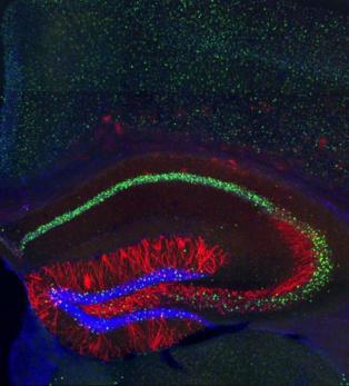 Los neurocientíficos del MIT han identificado las células (en rojo) en las que se almacenan las trazas de memoria, en el hipocampo de ratones. Imagen: Steve Ramírez y Xu Liu. Fuente: MIT. 