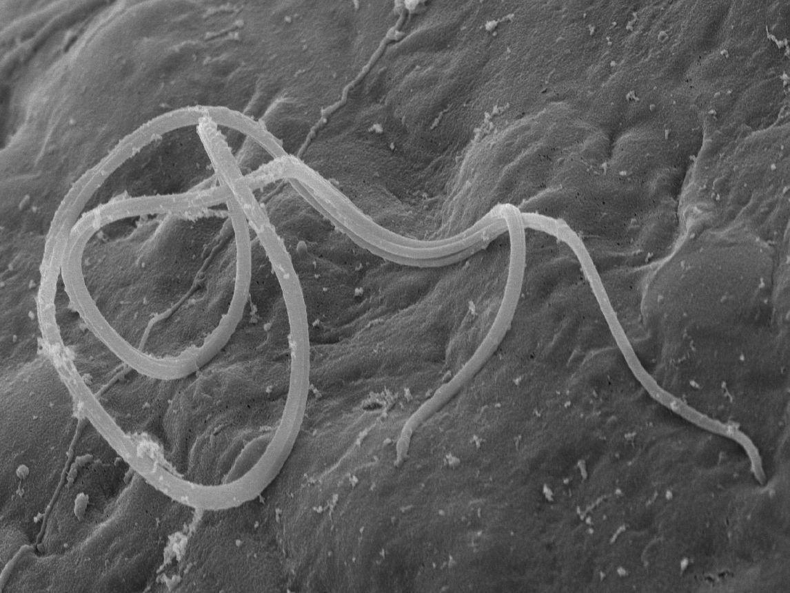 Espermatozoide del escarabajo rojo de la harina. Foto : University of East Anglia.