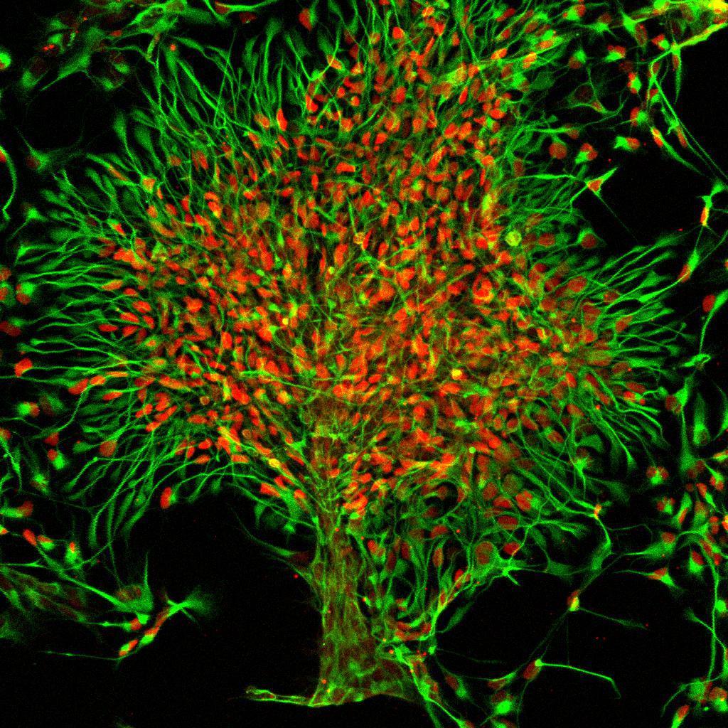 Células madre neurales del cerebro de un chimpancé, utilizadas en esta investigación para compararlas con el desarrollo de un cerebro humano. Imagen: Instituto Salk / Carol Marchetto / Ana PD Mendes.