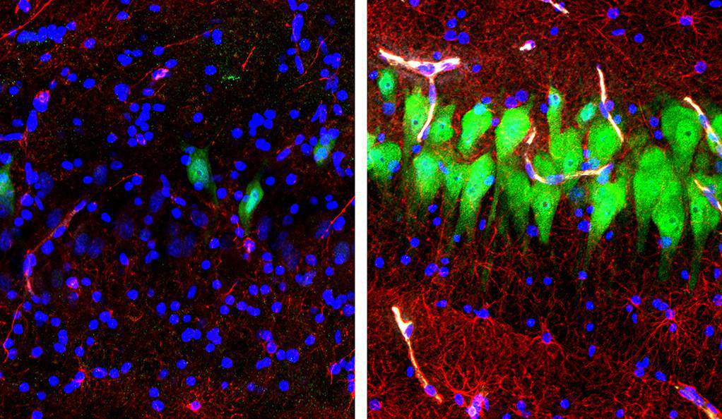 Región del hipocampo del cerebro de un cerdo del experimento. A la izquierda, antes del tratamiento, se aprecian en verde las neuronas y en rojo los astrocitos (células gliales fundamentales para la actividad nerviosa). A la derecha, ambos colores se han extendido, reflejando actividad cerebral más de cuatro horas después de la muerte del animal. Imagen: Stefano G. Daniele y Zvonimir Vrselja. Universidad de Yale.