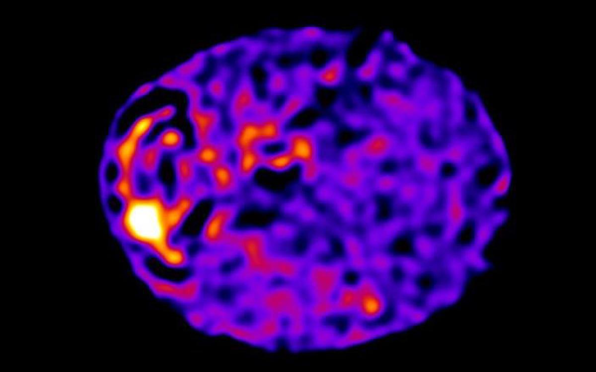 Las primeras imágenes de la web de toda la célula se capturaron con la ayuda de técnicas informáticas similares a las utilizadas para obtener la primera imagen de un agujero negro. Foto: Universidad de Edimburgo.