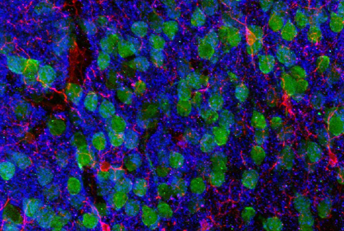 Corteza prefrontal medial que muestra neuronas corticales (verdes), microglías (rojas) y el marcador post-sináptico PSD95 (en azul). Crédito: Christopher Parkhurst y David Artis (WCM).