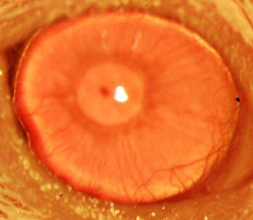 Córnea functional restaurada tras el trasplante de células madre limbares humanas en un modelo de ratón con deficiencia de células madre limbares. Imagen: Paraskevi Evi Kolovou, Bruce Ksander, y Natasha y Markus Frank. Fuente: Massachusetts Eye and Ear/Schepens Eye Research Institute.