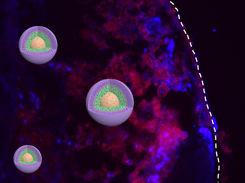 Nanopartículas a la búsqueda de tejido tumoral. Fuente: Universidad de Illinois.