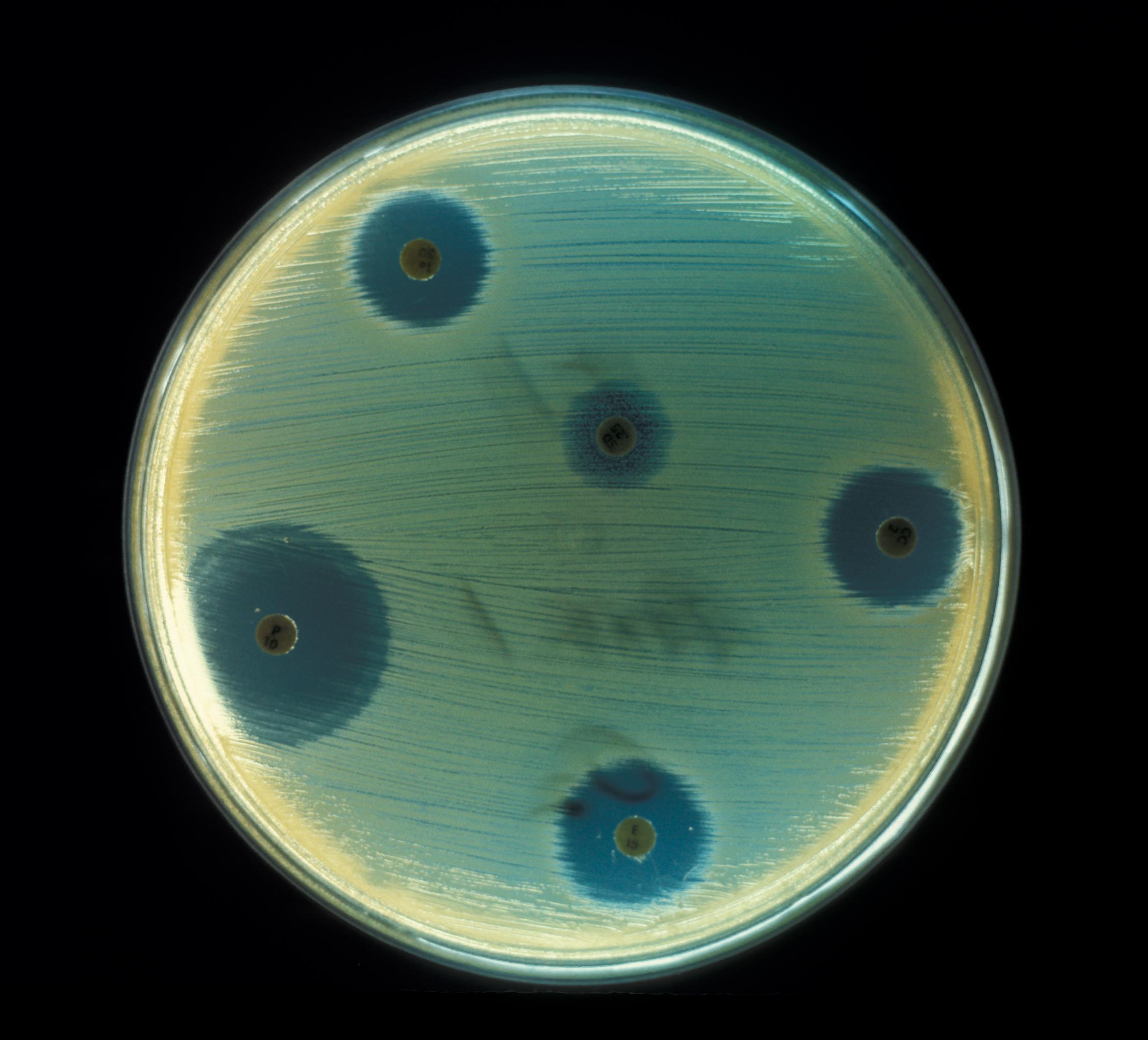 Test de susceptibilidad de la bacteria 'Staphylococcus aureus' a los antibióticos. Fuente: Centre for Disease Control/Wikipedia.