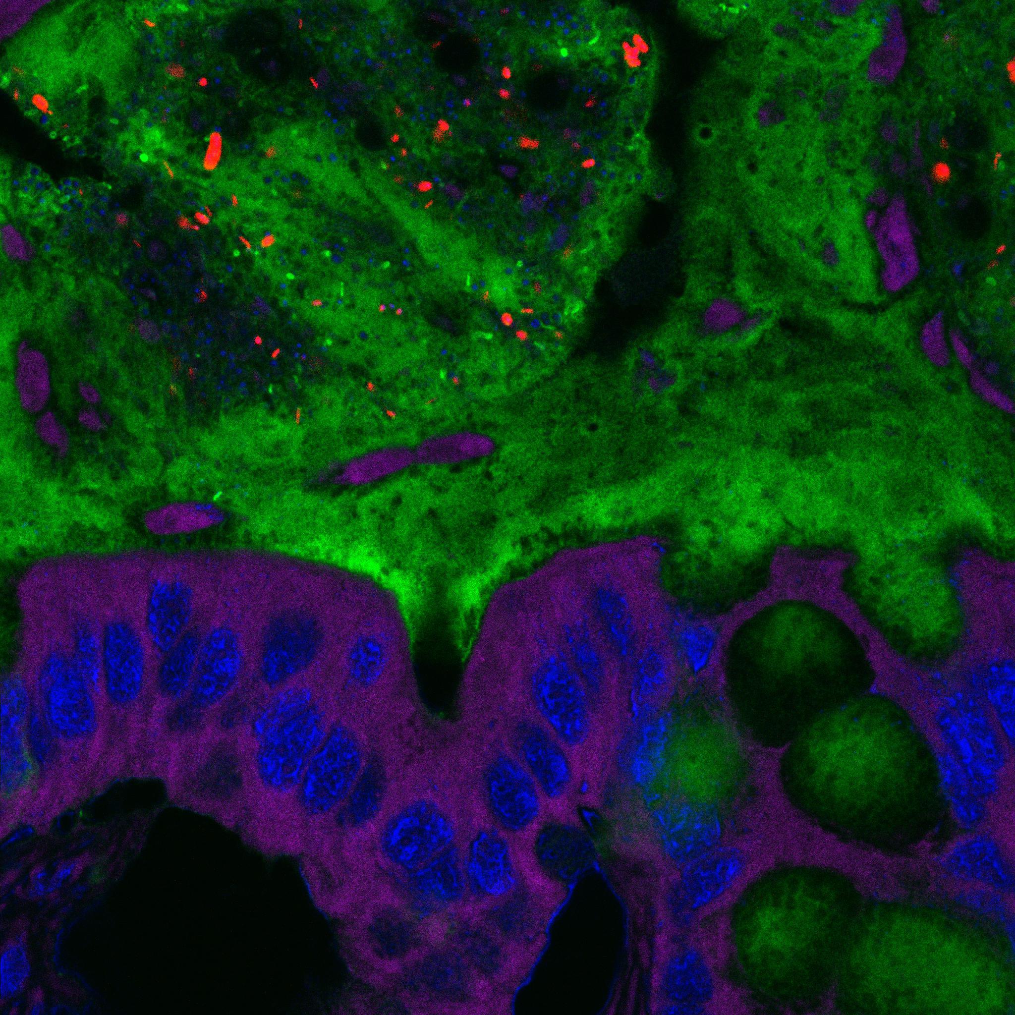 Bacterias en la capa de mucosidad del intestino, más cerca de las células epiteliales de lo que deberían. Imagen: Benoit Chassaing. Fuente: Universidad del Estado de Georgia.