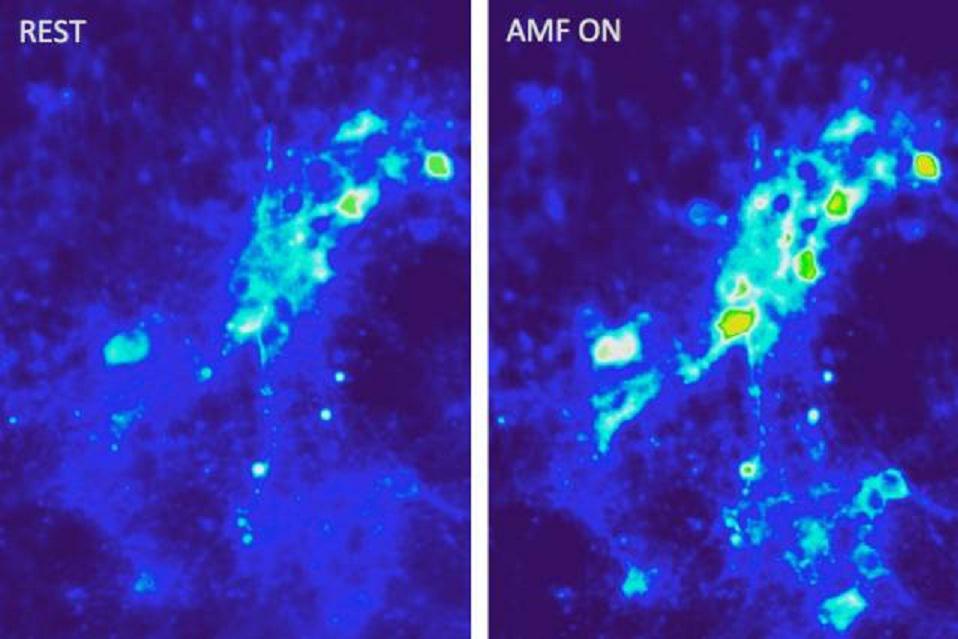 Imágenes que muestran la afluencia de iones de calcio en las neuronas, como resultado de la excitación magnetotérmica llevada a cabo con campos magnéticos alternos, y en presencia de nanopartículas magnéticas. Imagen: Cortesía de los autores de la investigación. Fuente: MIT.