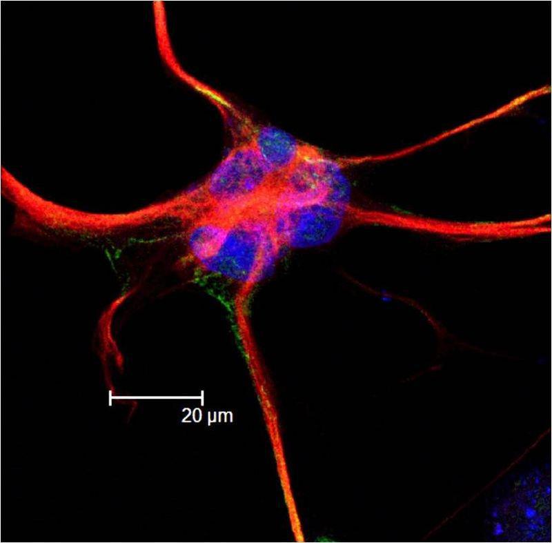 Imagen tomada con un microscopio confocal de un astrocito aislado. Fuente: «Astrocytre» de Neurorocker en en.wikipedia. Disponible bajo la licencia CC BY 3.0 vía Wikimedia Commons.