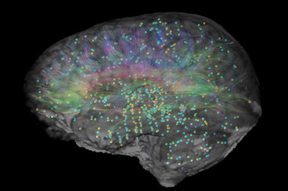 Atlas del cerebro. Fuente: Allen Institute.