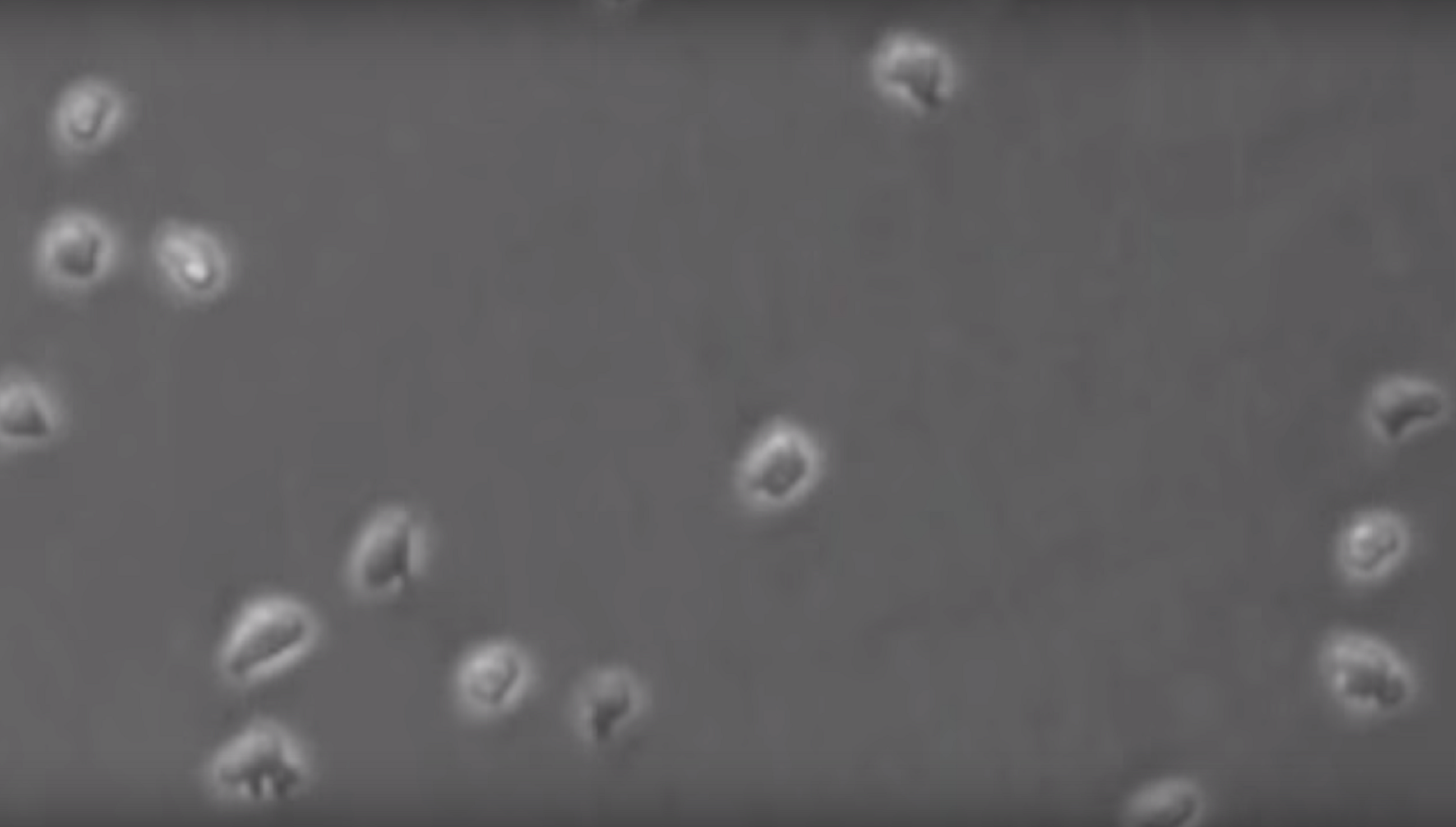 Amebas moviéndose por la acción de un campo eléctrico. Fuente: UC Davis.