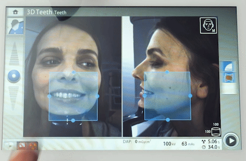 Podcast - TC Cone Beam