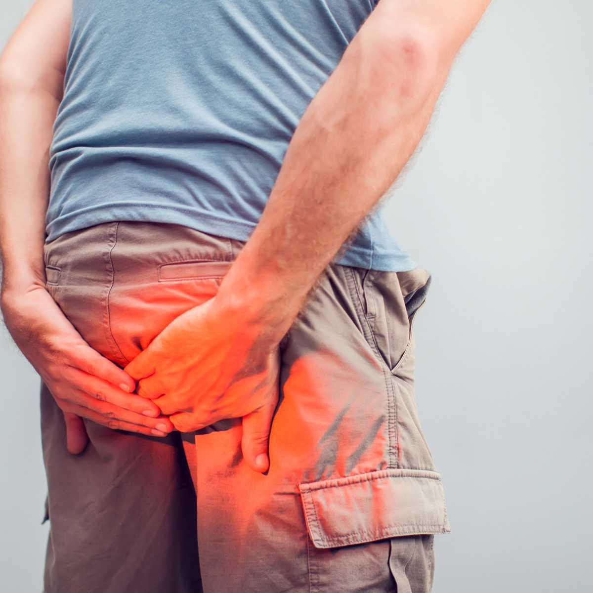 Haemorrhoids