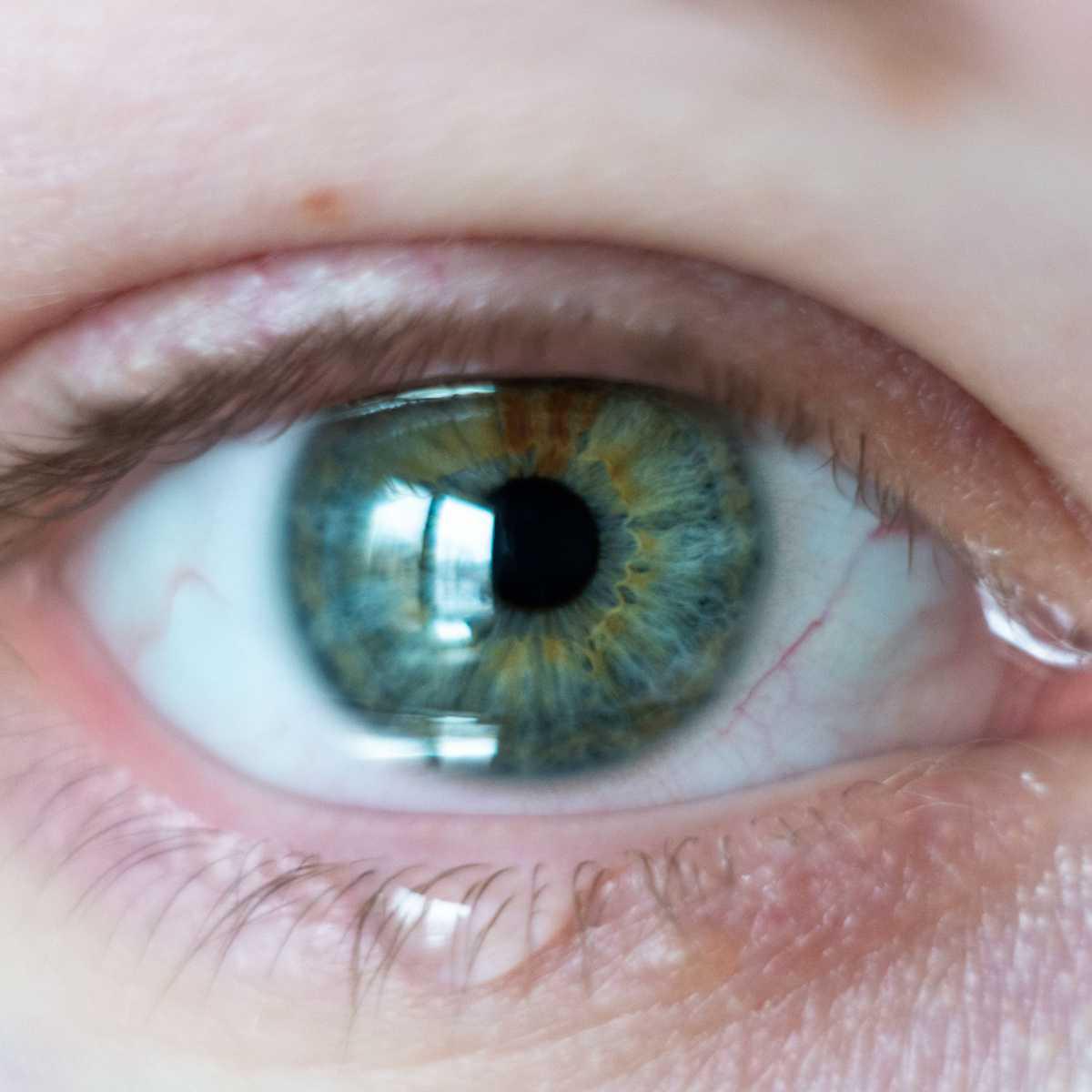 Watery eyes