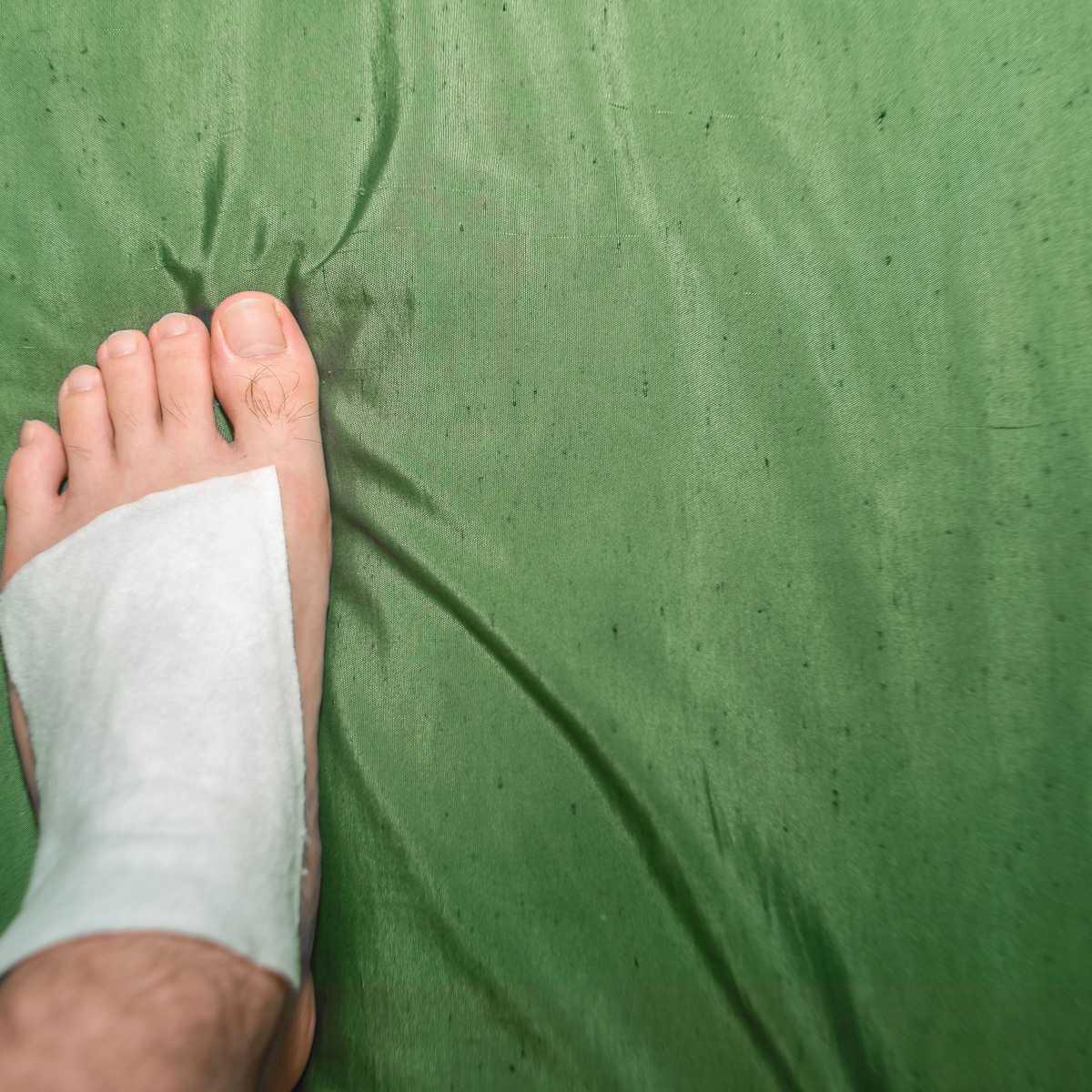 Clay poultice