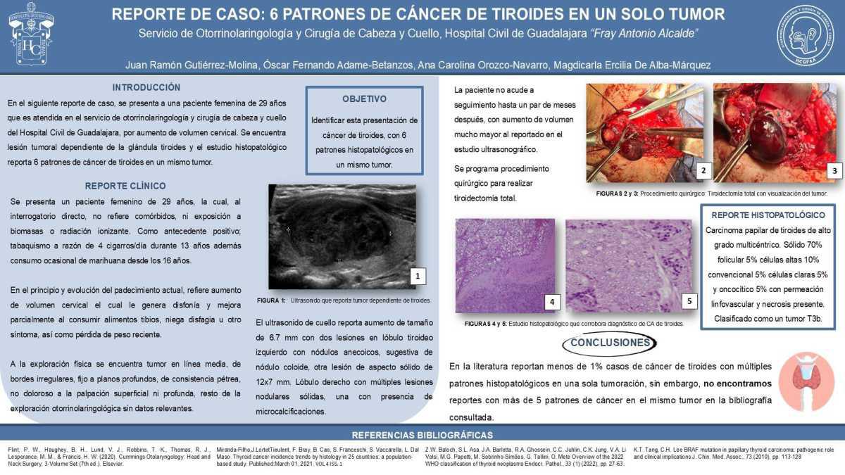 CNUM 1 - 6 PATRONES DE CÁNCER DE TIROIDES EN UN SOLO TUMOR