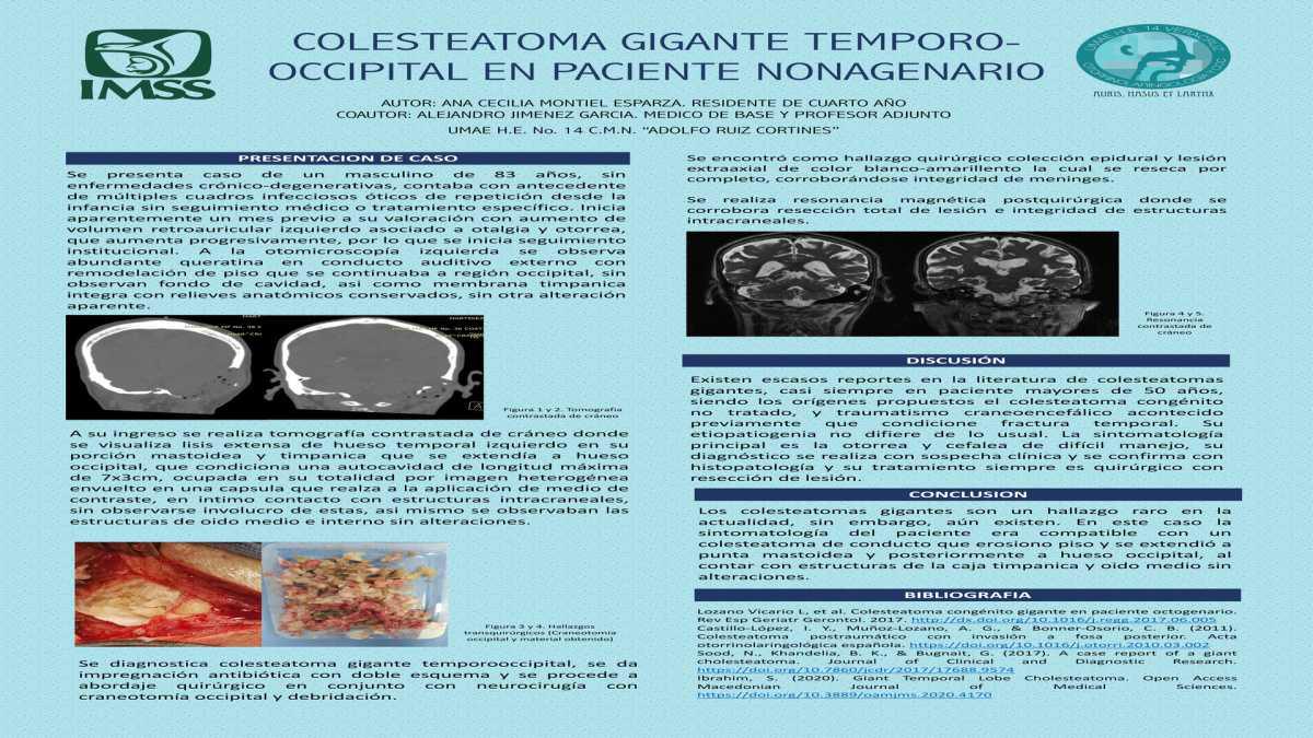 CNUM 3 - COLESTEATOMA GIGANTE TEMPORO-OCCIPITAL EN PACIENTE NONAGENARIO