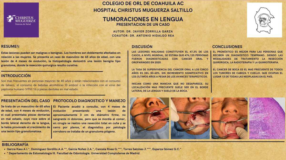 CNUM 6 - TUMORES EN LENGUA Y PRESENTACIÓN DE UN CASO